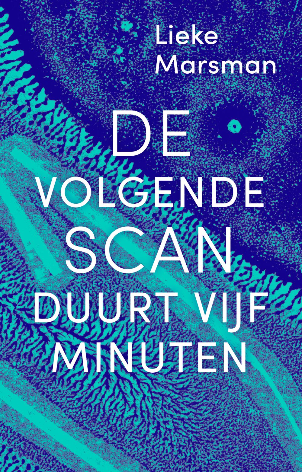 De volgende scan duurt vijf minuten